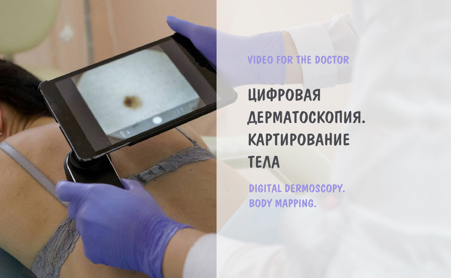 Цифровая дерматоскопия